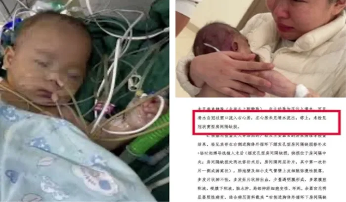 宁波,小洛熙,尸检,手术,重大失误,宁波大学,附属妇女儿童医院,陈君贤,心脏