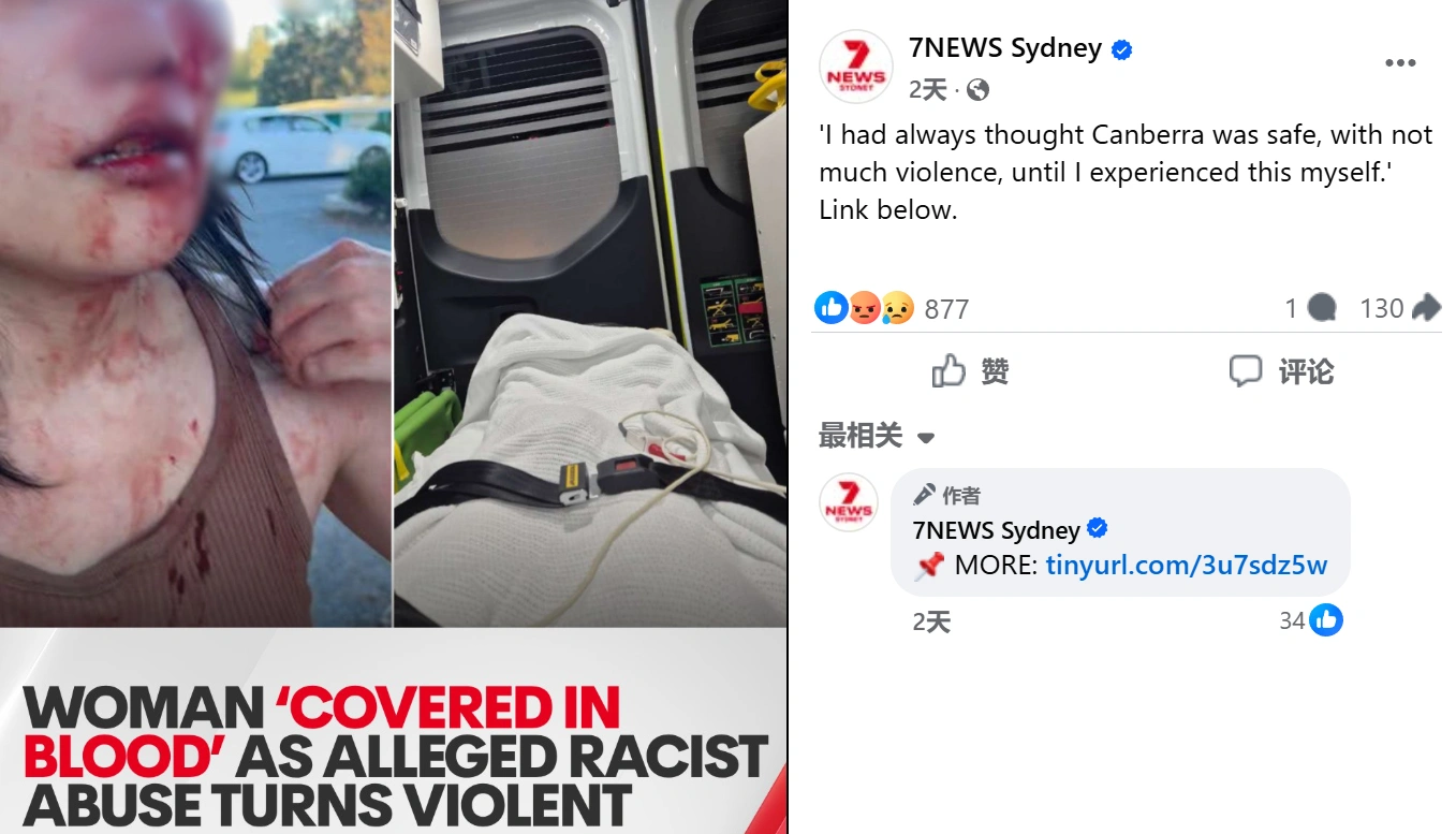 中国女子在堪培拉被打 “浑身是血”。(截图取自facebook/7NEWS Sydney﻿)